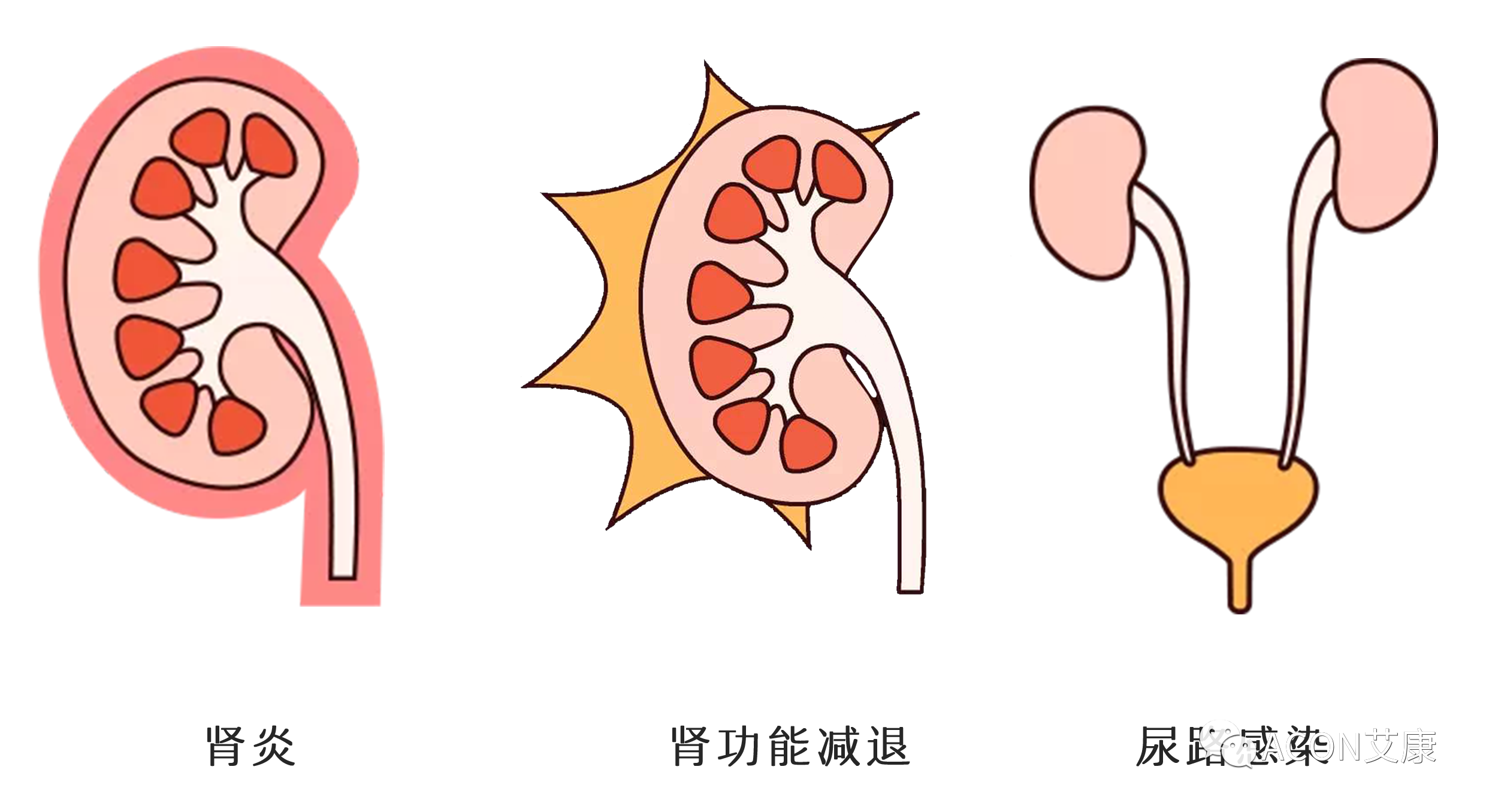 排尿黃、異味大，可能是身體在報警！