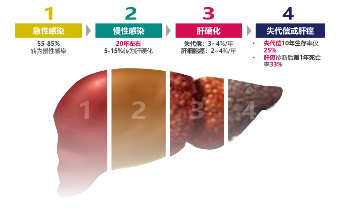 悄悄變成肝硬化、肝癌，很多人感染了卻不知道