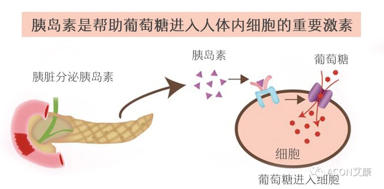 爆上熱搜，因爆發(fā)型糖尿病進(jìn)入ICU，有哪些教訓(xùn)值得我們汲取