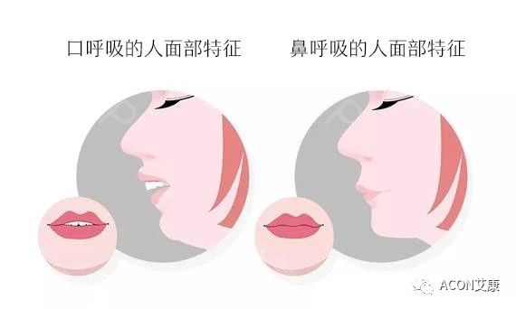 過敏性鼻炎會(huì)讓孩子變傻？！家長該如何應(yīng)對(duì)